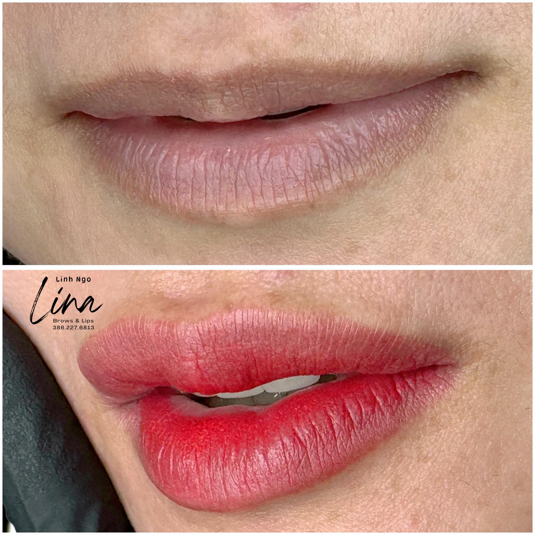 lips